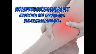 Kompressionstherapie  Symptome der Thrombose und Erstmaßnahmen [upl. by Anuaik]