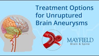 Mayo Clinic Study on Brain Aneurysms [upl. by Siloam]