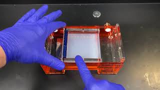 Agarose Gel Electrophoresis [upl. by Onit748]