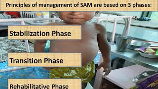 Severe Acute Malnutrition Part 14  Appetite test  Pediatrics [upl. by Vtarj]