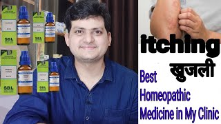 Best Homepathic medicine for itching in my clinic  ep14 part 1 [upl. by Anitsugua]