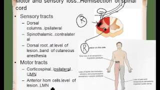 ipsilateral contralateral [upl. by Walden]