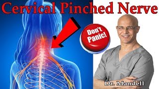 How to Overcome Cervical Pinched Nerve amp Radiculopathy Dont Panic  Dr Alan Mandell DC [upl. by Elletsyrc133]