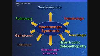 Ischemic Reperfusion Injury Pathology  Explained Simply 2024 [upl. by Yemerej364]