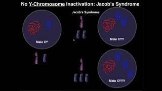 Jacobs Syndrome  A YChromosome Aneuploidy [upl. by Gard802]