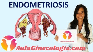 ENDOMETRIOSE o que é e o que fazer [upl. by Beulah]