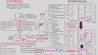 Liver Cirrhosis SandS Pathophysiology Investigations Management [upl. by Eylrahc]