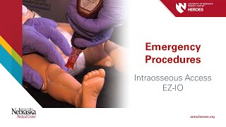 Emergency Procedures Intraosseous Access  EZIO [upl. by Oliy]