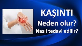 KAŞINTI NEDEN OLUR NASIL TEDAVİ EDİLİR [upl. by Enelahs]