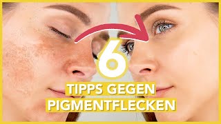 Pigmentflecken entfernen – die 6 BESTEN TIPPS gegen Hyperpigmentierung [upl. by Atalante]