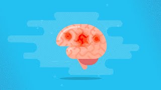 Acute Ischemic Stroke Etiology Pathophysiology Clinical Features Diagnostics Treatment [upl. by Eruot]