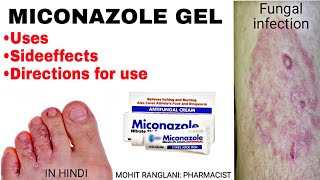 Miconazole nitrate cream  Uses sideeffects directions  Fungal infection treatment in Hindi [upl. by Branca]