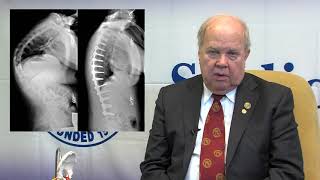 SRS Patient Video Kyphosis  George H Thompson MD [upl. by Atinahc837]