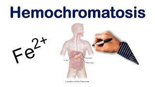 Hemochromatosis  USMLE COMLEX NCLEX [upl. by Lesna]