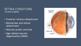 HYPERTENSIVE RETINOPATHY  DETAILED EXPLAINATION [upl. by Adnirod]