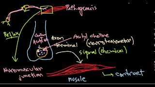 What You Need To Know About C Difficile Infection [upl. by Wenn]