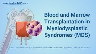 Haematopoietic Stem Cell Transplantation HSCT for MS at London Bridge Hospital [upl. by Salene]