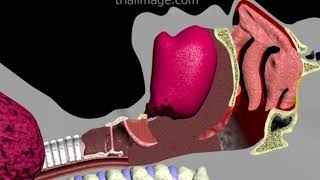 Endotracheal Intubation Animation by Cal Shipley MD [upl. by Ik]