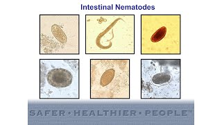 Diagnostic Features of Intestinal Nematodes [upl. by Atinor]