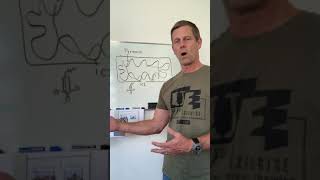 Metformin and Lactic Acidosis [upl. by Olinde]