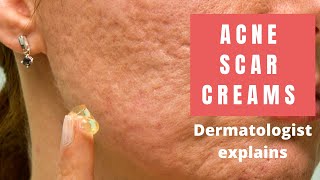 Acne Scar Creams  Dermatologist Reviews [upl. by Lleryd858]