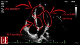 Foundations of Echocardiography BSE Level 1 Focused Scan [upl. by Ysirhc]