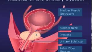 Botox Injections for Bladder Conditions [upl. by Moina16]