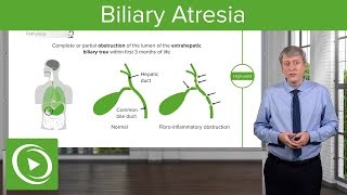 Biliary Atresia – Pediatrics  Lecturio [upl. by Eanyl]