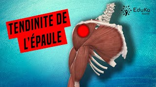 COMPRENDRE LA TENDINITE DE LÉPAULE Explications professionelles [upl. by Venetia]