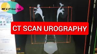 Your Radiologist Explains Intravenous Pyelogram IVP [upl. by Leacock]