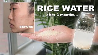 We used RICE WATER for 3 months and cant believe the results [upl. by Lazos889]