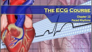 The ECG Course  Paced Rhythms [upl. by Jeni998]