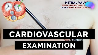 Cardiovascular Examination  OSCE Guide  UKMLA  CPSA  PLAB 2 [upl. by Goetz559]