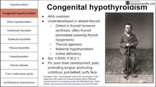 Hypothyroidism Hyperthyroidism and Thyroiditis [upl. by Onstad]