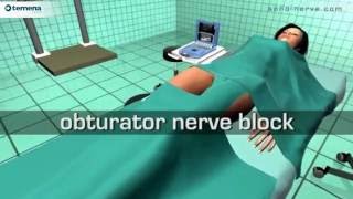 Obturator Nerve Block [upl. by Hannasus]