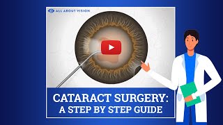 CATARACT MACULA EDEMA SURGERY COMPLICATION macular edema after cataract surgery [upl. by Isaac]