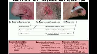 Advanced Cancer and End of Life Care [upl. by Allan875]