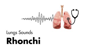 Rhonchi  Lung Sounds  Medzcool [upl. by Swope]