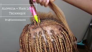 NEW TECHNIQUE ALOPECIA  HAIR LOSS BOX BRAIDS  IRENESBRAIDS [upl. by Goodden]