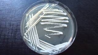 Streak Plate Method  Amrita University [upl. by Northington]