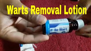 Wart Removal Lotion [upl. by Aivon453]