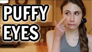 How to get rid of puffy eyes Dr Dray [upl. by Westbrook]