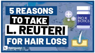 Top 5 Reasons To Take L REUTERI for HAIR LOSS [upl. by Hallock]