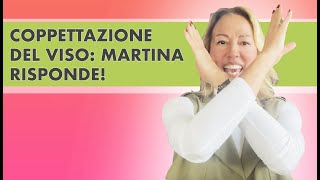 COPPETTAZIONE VISO funziona “Martina risponde”  episodio 2 [upl. by Freddi]