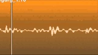 Echo Challenge Mitral Regurgitation [upl. by Sirtimed]