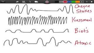 Irregular Breathing Patterns  EMTprepcom [upl. by Ardine502]