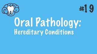 Oral Pathology  Hereditary Conditions  INBDE ADAT [upl. by Male182]