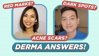 How to treat ACNE SCARS amp ACNE MARKS Dermatologist Answers Filipino  Jan Angelo [upl. by Scrivings517]