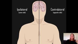 Ipsilateral vs Contralateral [upl. by Patrica273]