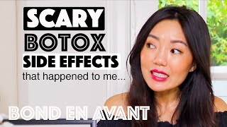 I almost RUINED my face  Botox Masseter [upl. by Roxie]